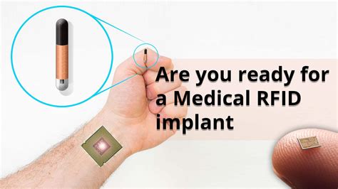 rfid chip why is got one|chip implantation in humans.